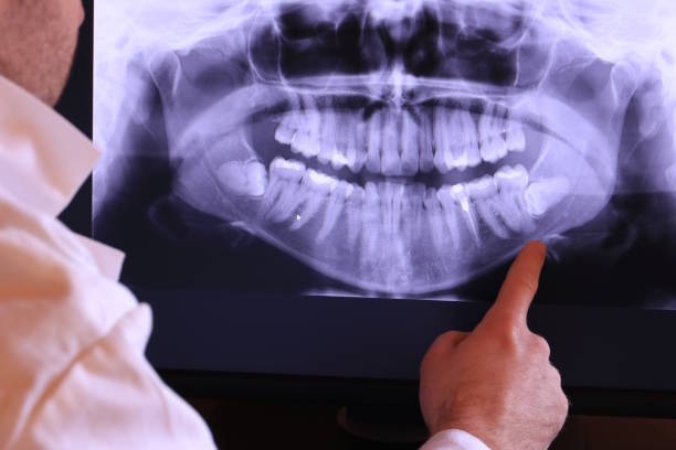 Best Weekend Emergency Dentist in South Bound Brook, NJ